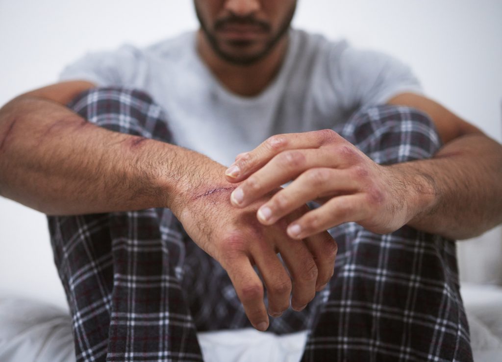 bpd-in-men