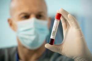 blood-test-for-cocaine-use