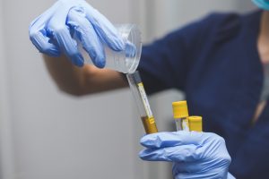 urine-test-for-cocaine-use